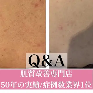 ミディアム カラー パーマ ヘアアレンジ メンズ キッズ ネイル マツエク・マツパ ニキビ・肌質改善専門 ♡人生が変わるサロンのエステ・リラクイメージ