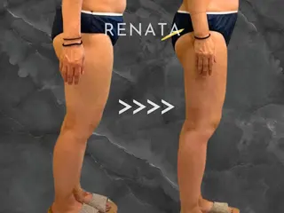 脂肪冷却専門店 RENATA新宿のエステ・リラクイメージ