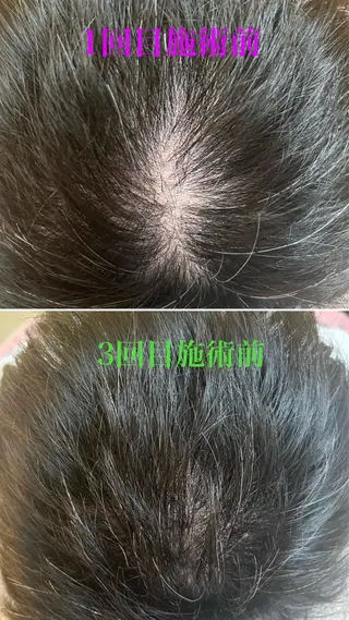 アロマ･美容鍼･カッ ピング「麗」鍼灸院のエステ・リラクイメージ