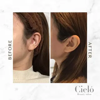 Cielo 赤坂店のエステ・リラクイメージ