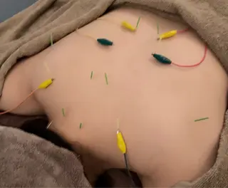 TIARABO 小顔特化美容鍼のエステ・リラクイメージ