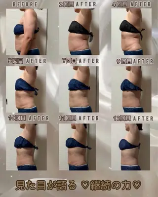 ヴィーナス ビューティーのエステ・リラクイメージ