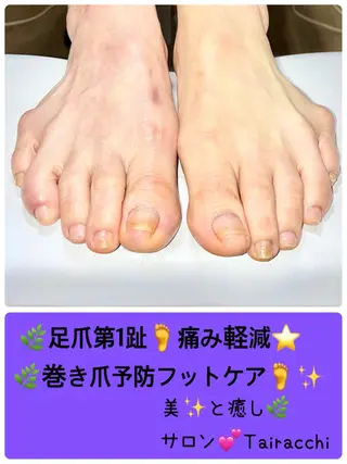 ネイル Tairacchi ﾀｲﾗｯﾁのエステ・リラクイメージ