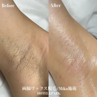 HOTEL&PARK Mikuワックス脱毛のエステ・リラクイメージ