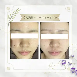 《 肌質×美肌 》 addissimoのエステ・リラクイメージ