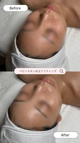 韓国肌管理🫧LDM 🫧Junnaのエステ・リラクイメージ