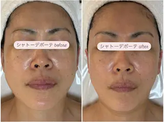 肌質改善|天王寺 For...はるかのエステ・リラクイメージ