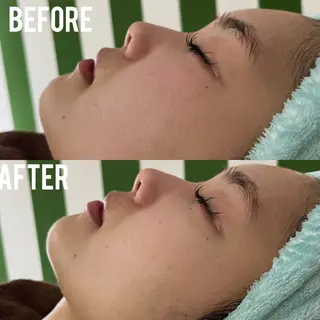 MEITY新宿所属・小顔、毛穴ケア 通い放題エステのエステ・リラクイメージ