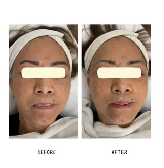 grow所属・Yoshino Erinaのエステ・リラクイメージ