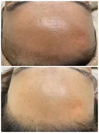 salon de lavju所属・美まつげと美肌サロン lavjuのマツエク・マツパデザイン