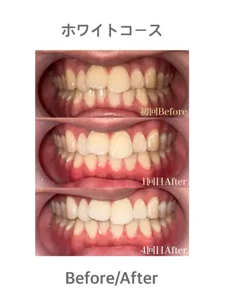 セルフホワイトニングサロンMUSE所属・セルフホワイトニング MUSE🫧焼津のその他イメージ