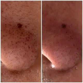 メンズ 毛穴ケア専門店 Cynthiaのエステ・リラクイメージ