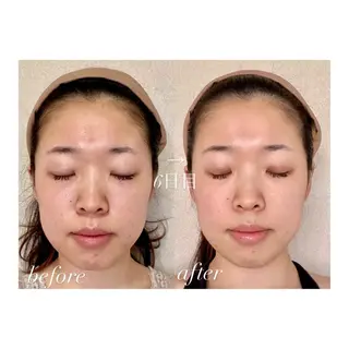 UnderGarden hair&spa所属・朴月香@Under Garden🌿‬のエステ・リラクイメージ