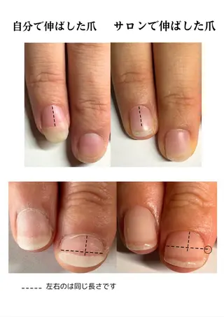 ネイル 深爪矯正専門店ネイルサロンKUU所属・ネイルサロン KUUのネイルデザイン