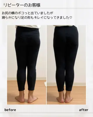 小顔矯正& 慢性肩こり腰痛改善店のエステ・リラクイメージ