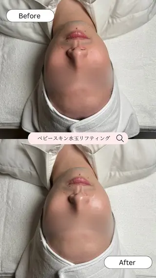 韓国肌管理🫧LDM 🫧Junnaのエステ・リラクイメージ