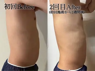 メンズ 六本木/似合わせ眉毛 andＳ🍀Yuriのエステ・リラクイメージ