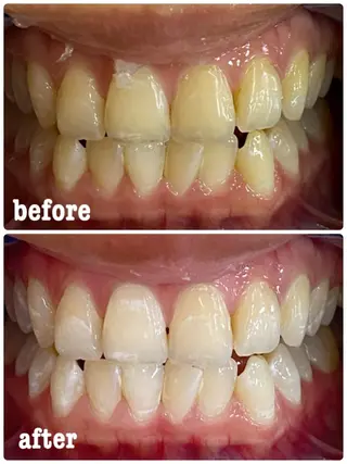 ホワイトニングサロン ラウレアのその他イメージ