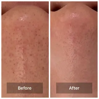 bonuru salonのエステ・リラクイメージ