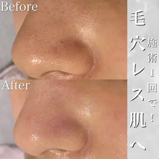 Rumia esthetic salon所属・芯美 -shinbi-のエステ・リラクイメージ