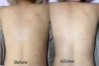 韓国美肌/肌質改善 【天神】yuiのエステ・リラクイメージ