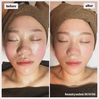 beautysalon  DiAViM所属・本格コルギ美肌美眉 DiAViM 💎のエステ・リラクイメージ