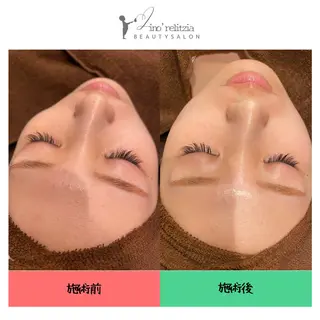 リノレリチア 新町店のエステ・リラクイメージ