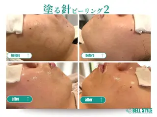 メンズ&レディース　Bell style所属・【脱毛・美肌専門】 bellstyleのエステ・リラクイメージ