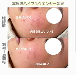 PRESS 高野🥀のエステ・リラクイメージ