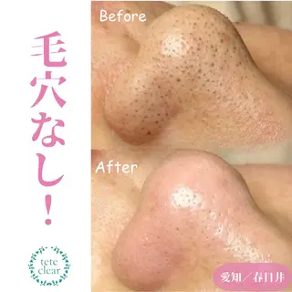 若山 遙子のエステ・リラクイメージ