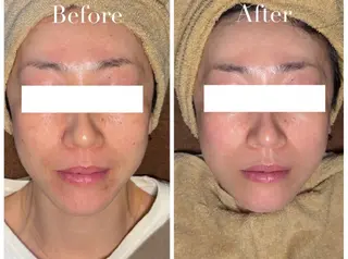 Avenir Brillant所属・松田 紗季のエステ・リラクイメージ