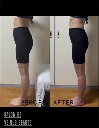 ヴィーナス ビューティーのエステ・リラクイメージ