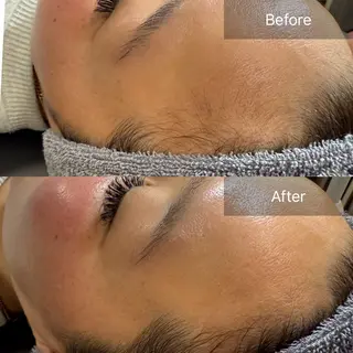 enine所属・enine フェイスWAXのエステ・リラクイメージ