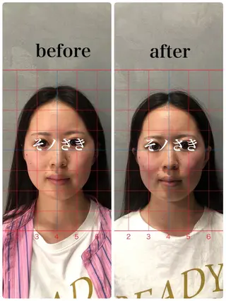 そノさき所属・大阪のシーサー🦁 島袋のエステ・リラクイメージ