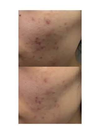 LukeBeauty salonのエステ・リラクイメージ