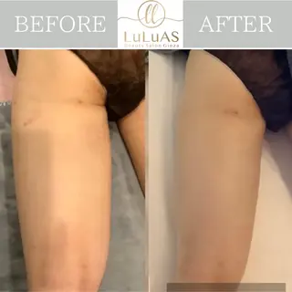 ルルアス GINZAのエステ・リラクイメージ