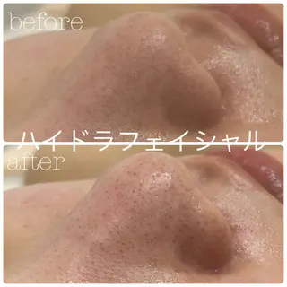 フェイシャルサロン CHIARA 荒田のエステ・リラクイメージ