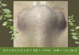 毛穴フェイシャル エステ専門店BBのエステ・リラクイメージ