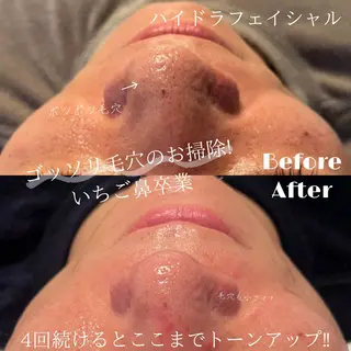 💎美容革命ラボ💎 大名店のエステ・リラクイメージ