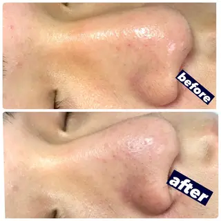 NAO 🌺のマツエク・マツパデザイン