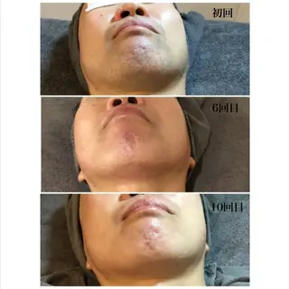 メディカルビューティーSalon Links所属・稲木 俊子のエステ・リラクイメージ