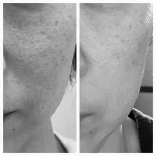 salon.plaisir（プレズィール）所属・酒井 瑠未のエステ・リラクイメージ