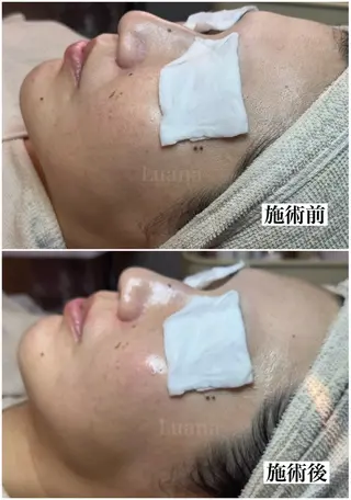 マツヤニWax専門/ 岸和田/Luanaのエステ・リラクイメージ