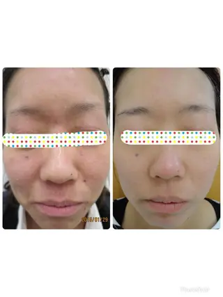 Facial stylist salon伊勢崎所属・中島 有希のエステ・リラクイメージ