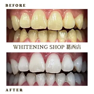 メンズ ホワイトニング ショップ葛西店のその他イメージ