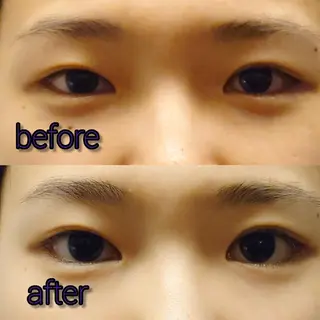 北梅田美容鍼灸院所属・美容鍼マイスター 川村　淳のエステ・リラクイメージ