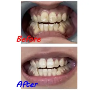 セルフホワイトニングサロン　ラヴィアン所属・ホワイトニングサロン La vie enのその他イメージ