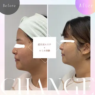 skinLabo所属・saya Mのエステ・リラクイメージ