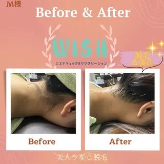 WISH 美肌脱毛のプロ！須藤のエステ・リラクイメージ