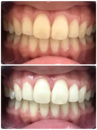 Beautyサロン noel de miのエステ・リラクイメージ